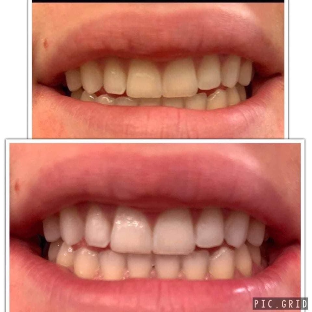 Whitening toothpaste!
